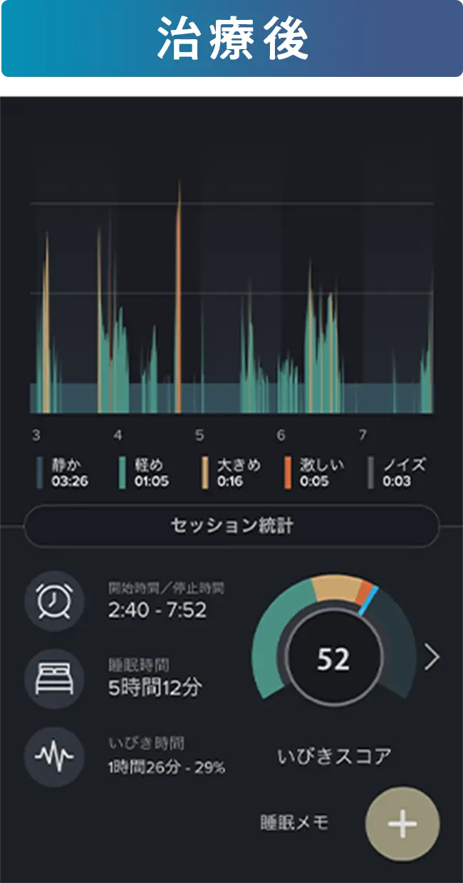治療後の音声データ