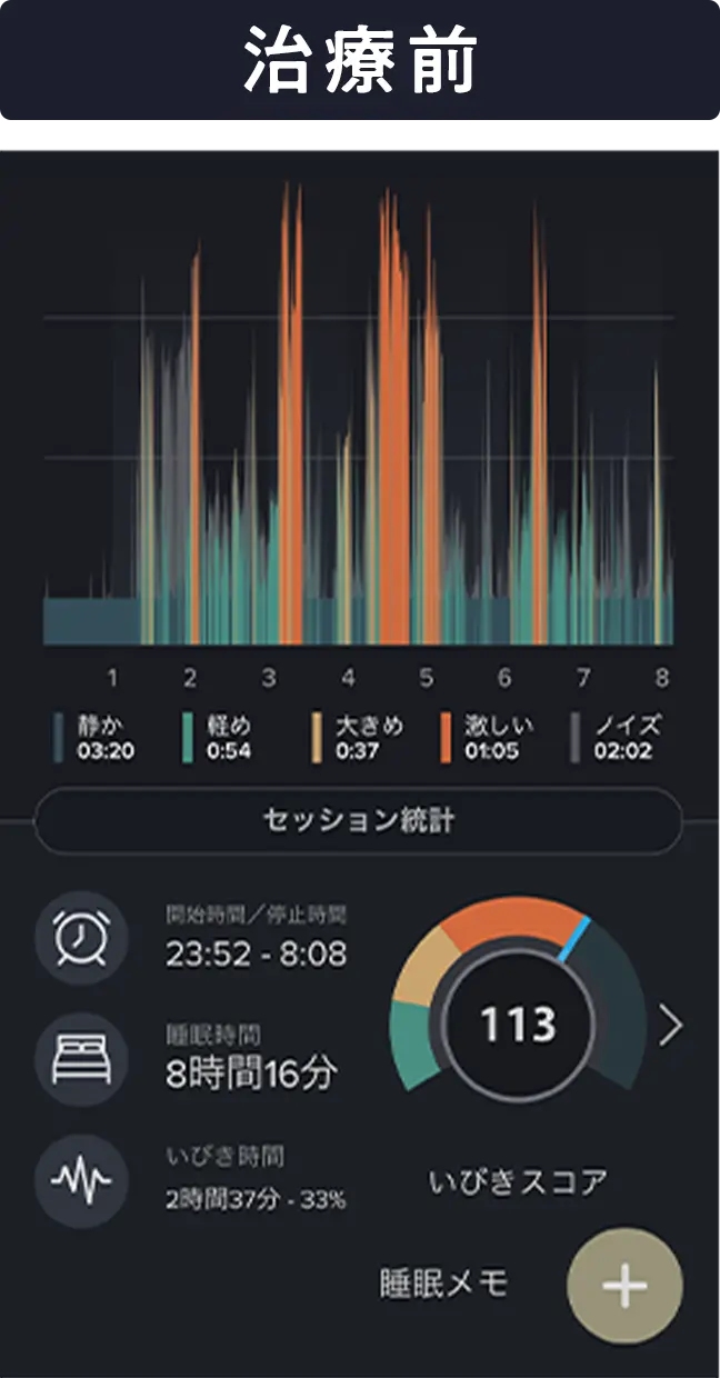 治療前の音声データ